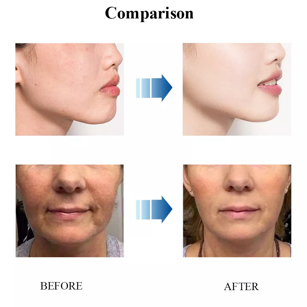 Face Cream Collagen Hyaluronic Acid Skin Care Anti-Wrinkle Moisturizing Anti-Aging Cream