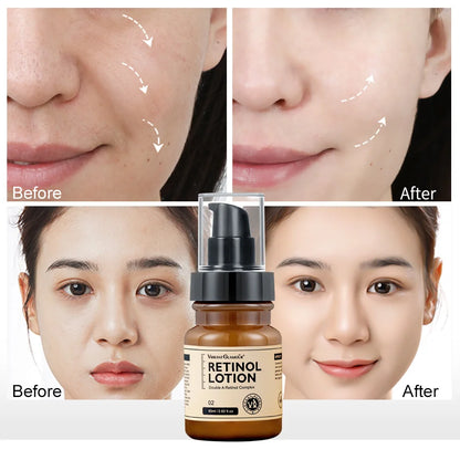 Retinol Face Lotion Cream Anti-Aging Wrinkle Removing Skin Moisturizer